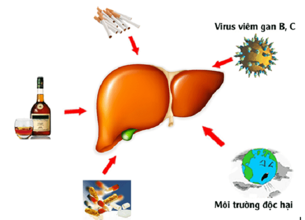 Điểm danh 4 nguyên nhân gây bệnh gan và các phương pháp | BvNTP